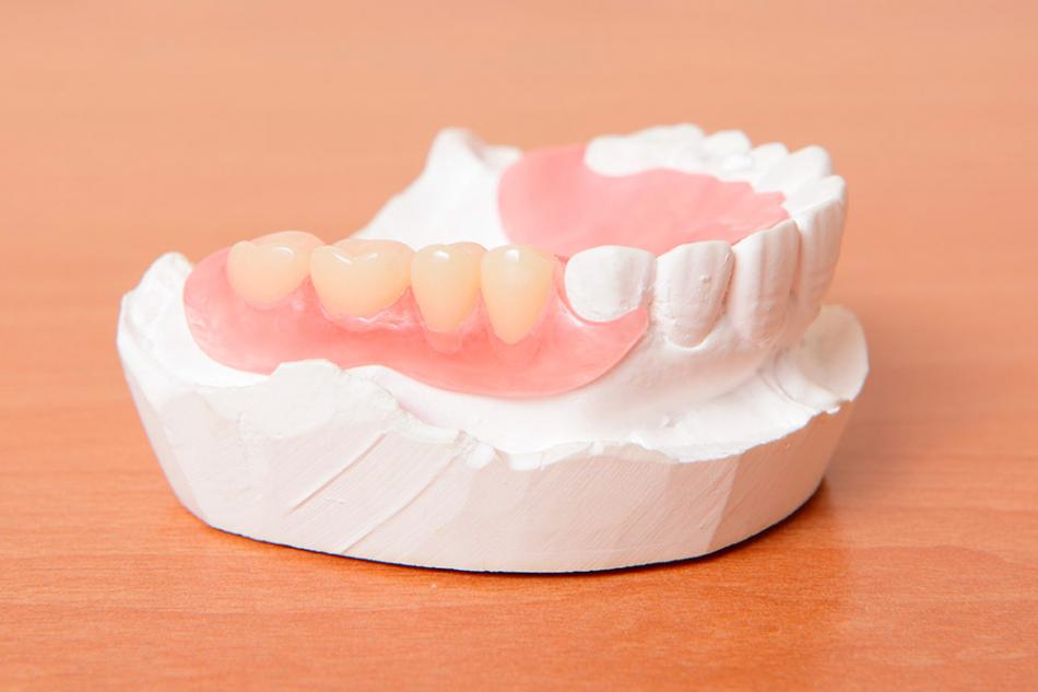 Когда протезирование зубов бывает бесплатным?