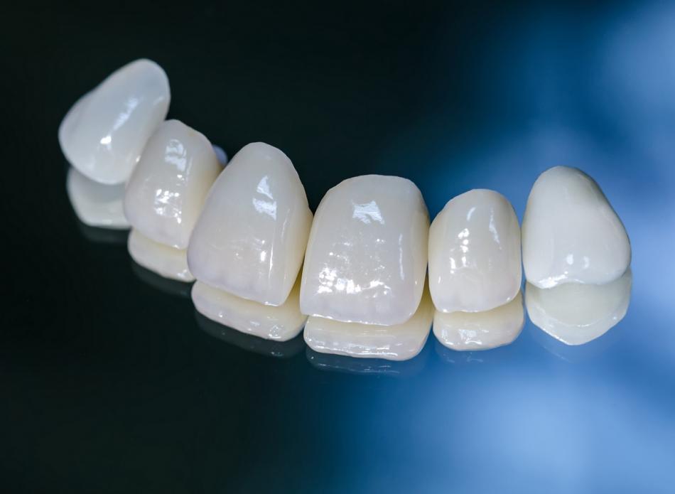 Сколько стоит металлокерамическая коронка на зуб?